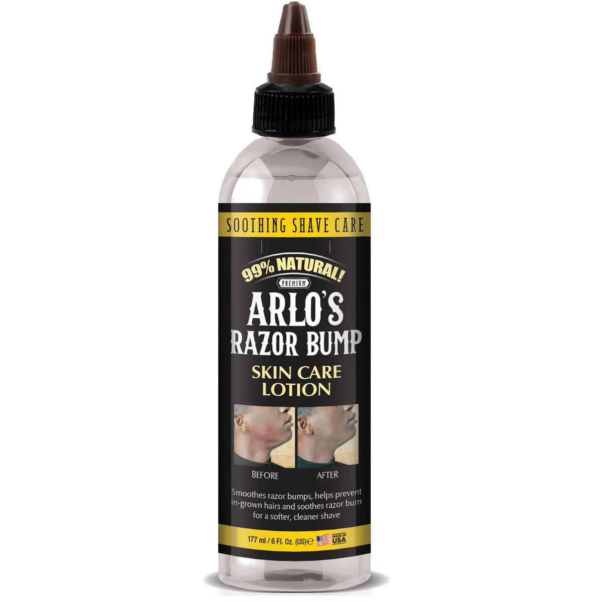 Arlo's Razor Bump Skin Care Lotion 6 fl oz bottle on white background